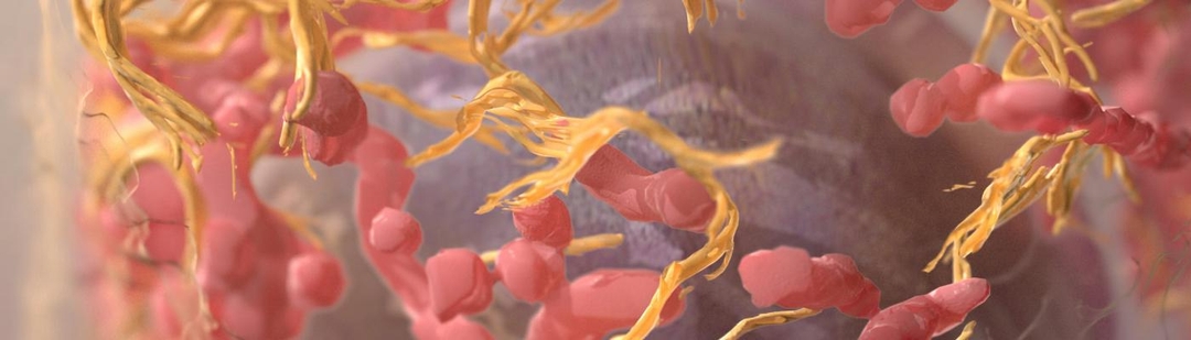 nanoparticula-podria-acabar-tumores-primarios-mama-metastasis-cerebrales-solo-tratamiento