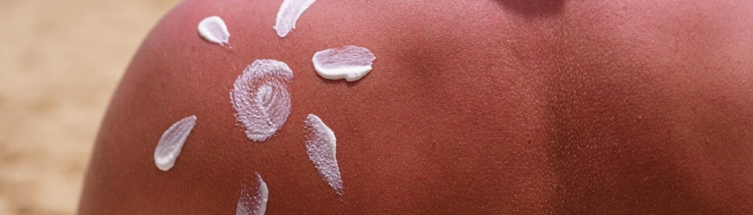 dia-europeo-prevencion-cancer-piel-sol-peligros