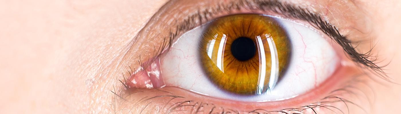 El color de ojo más común a nivel mundial es…