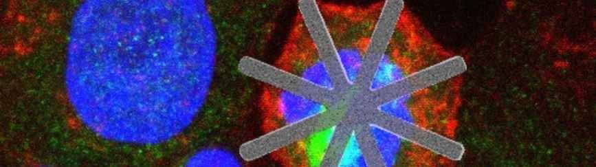 Introducen chips dentro de las células que actúan como fármacos para erradicar tumores