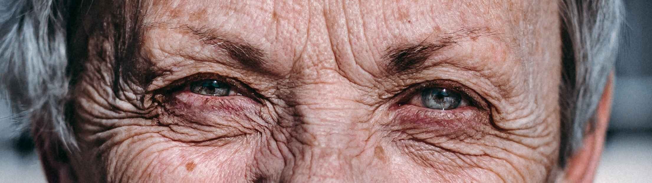 Un nuevo tratamiento contra la degeneración macular asociada a la edad
