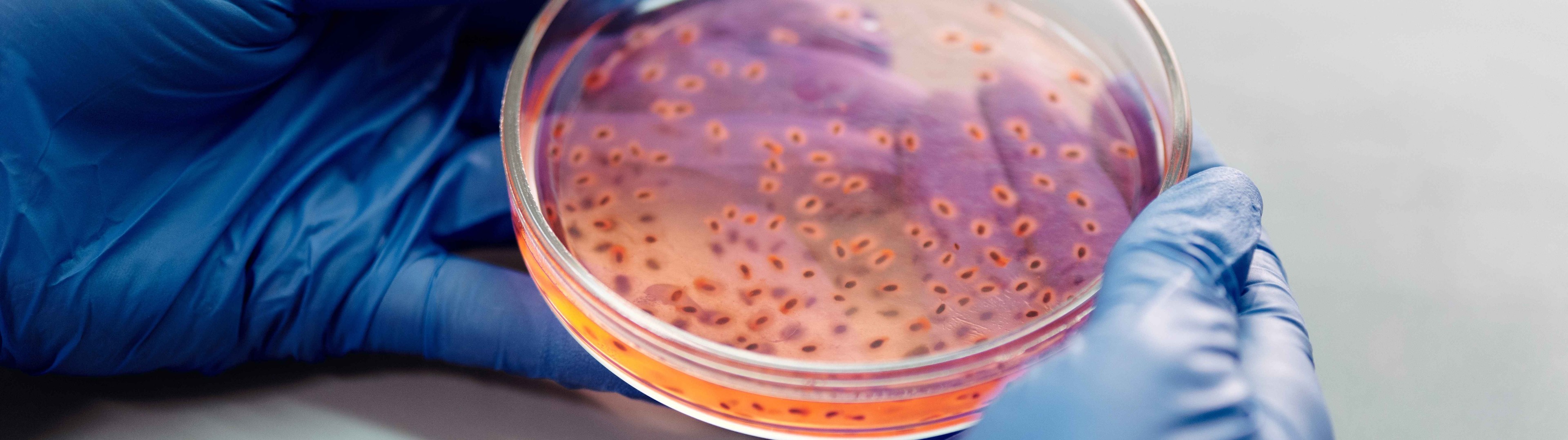 Descubren un nuevo fármaco  capaz de combatir 300 bacterias resistentes a medicamentos 