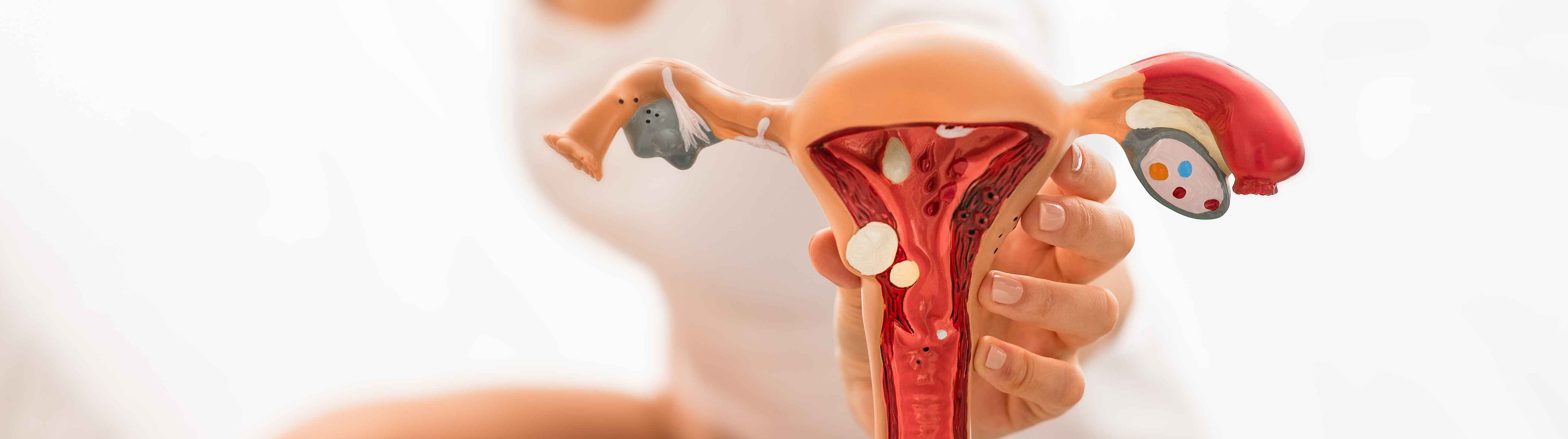 Es posible predecir el cáncer de endometrio con una prueba en casa