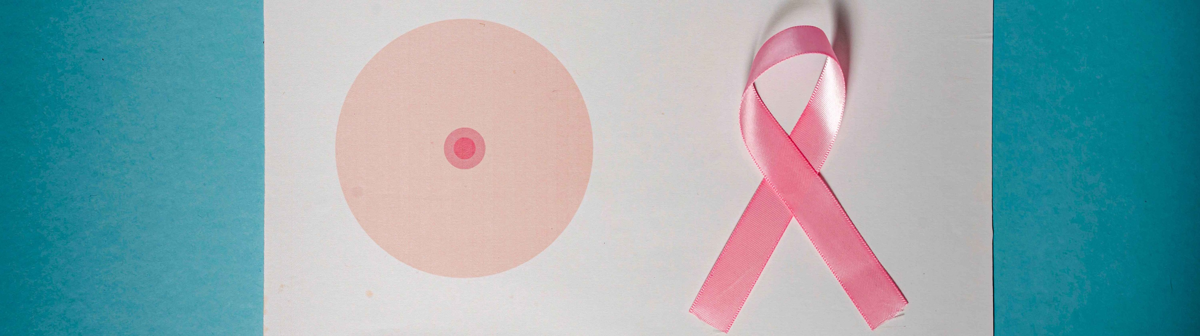 Técnica pionera para la reconstrucción del pezón en pacientes de cáncer de mama