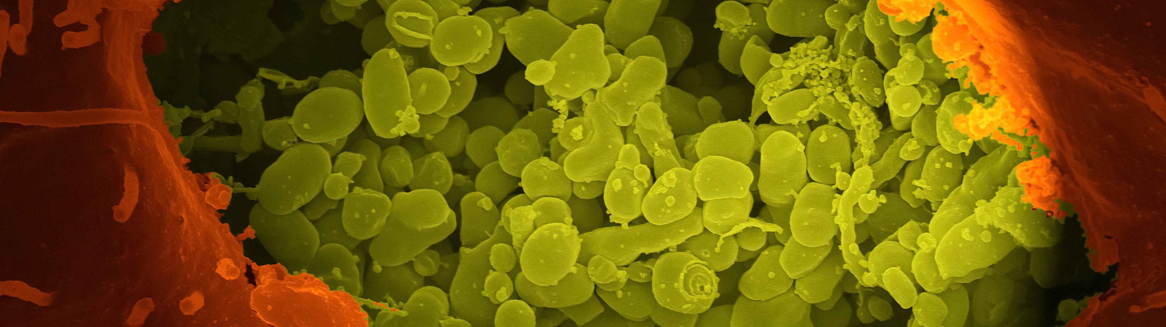 Investigadores españoles muestran la eficacia de combinar antibióticos frente a bacterias resistentes