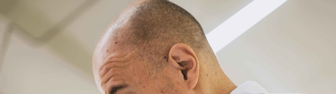 nuevo-avance-contra-la-alopecia:-consiguen-cultivar-pelo-en-un-laboratorio-1666612613992