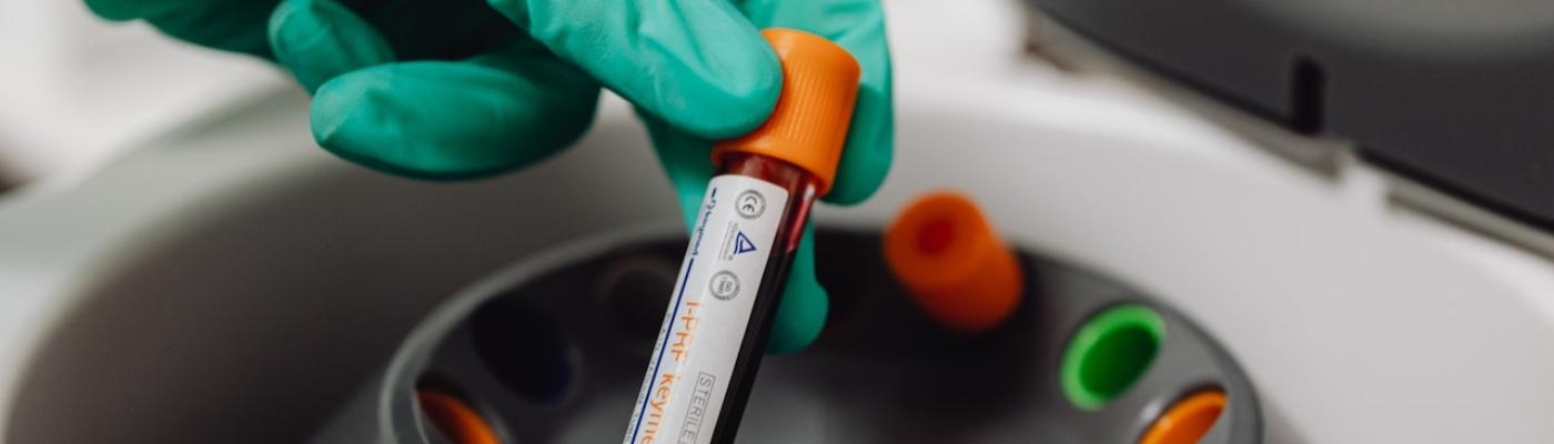 Primera trasfusión de sangre cultivada en laboratorio