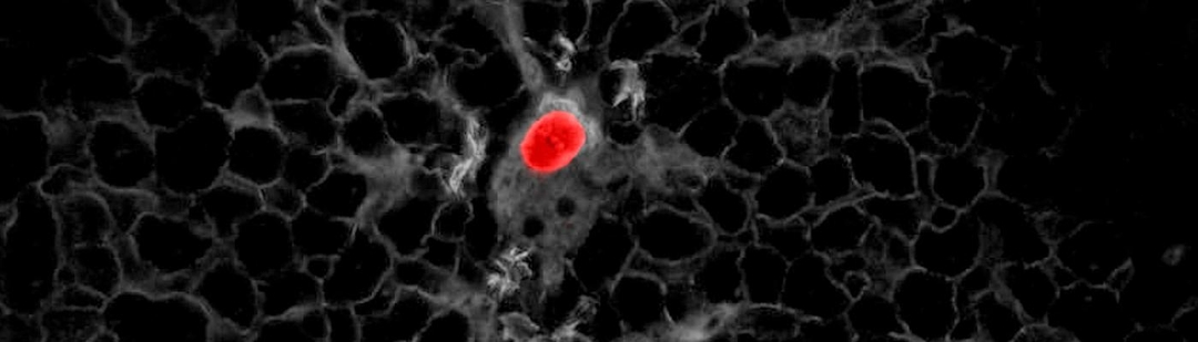 investigadores-espanoles-descubren-las-celulas-responsables-de-la-metastasis-en-el-cancer-de-colon