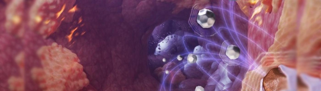 nanoparticulas-combatir-cancer-investigacion