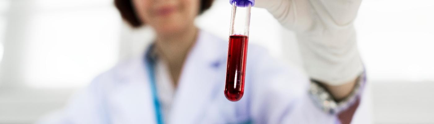 Una muestra de sangre ayudaría a predecir la supervivencia en enfermos de leucemia mieloide