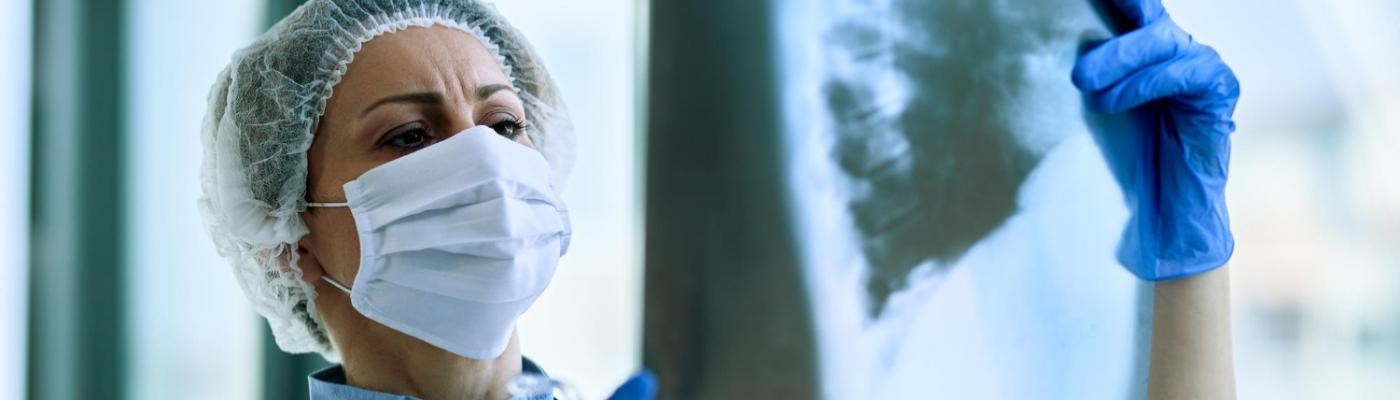 Descubren un mecanismo que evita la metástasis en el cáncer de pulmón