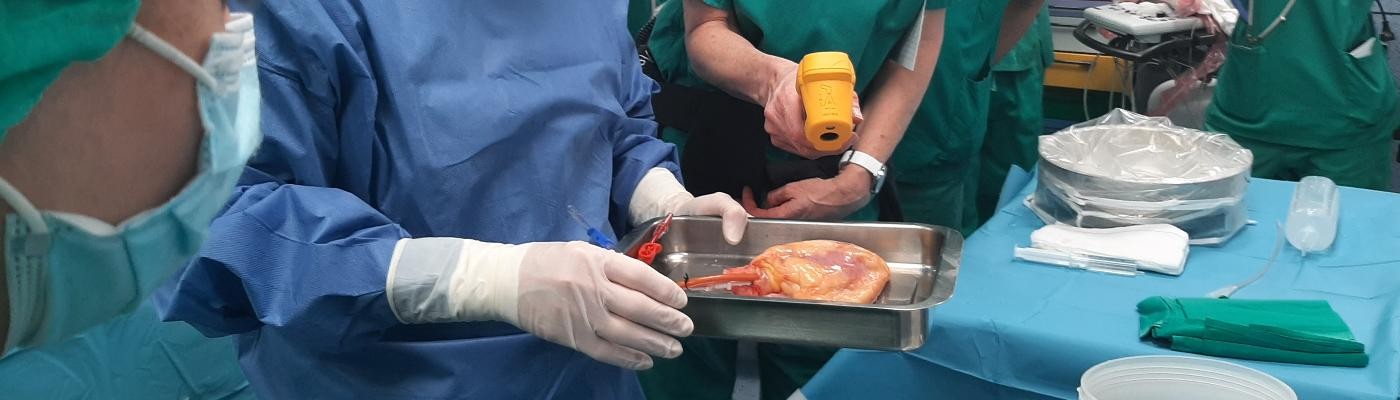 Primera donación de corazón en asistolia en un hospital sin cirugía cardíaca en Valencia