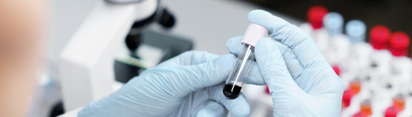 Llega a España el primer test de sangre para detectar el cáncer colorrectal  antes de que aparezca