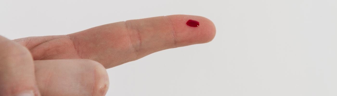 pinchazo-dedo-alternativa-analitica-sangre