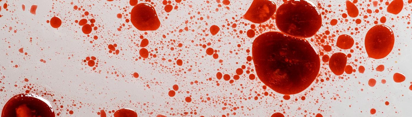 Una simple gota de sangre podría detectar VIH y hepatitis B y C