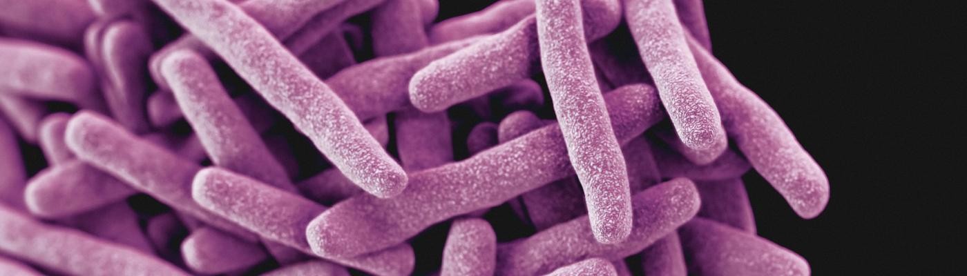 Europa alerta del aumento de casos de la bacteria multiresistente Shigella