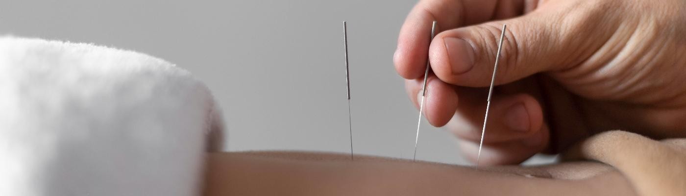 Existen cinco centros ilegales de acupuntura por cada 100 mil habitantes en España