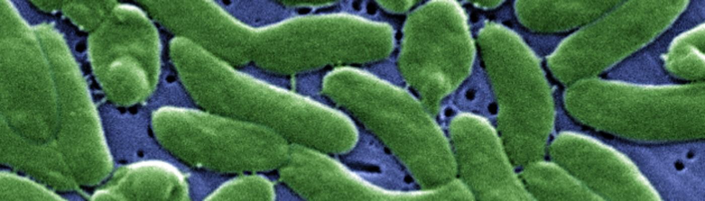 EE. UU alerta de la bacteria “come carne” en aguas del Atlántico y del Golfo de México