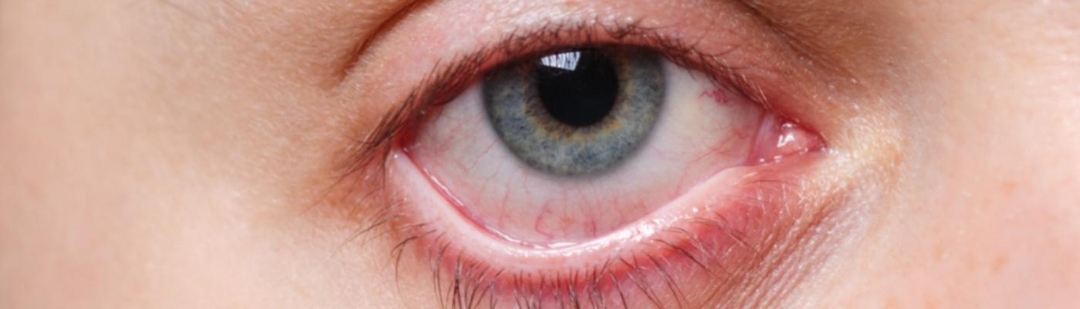 examen-ocular-podria-revelar-sindrome-covid-persistente