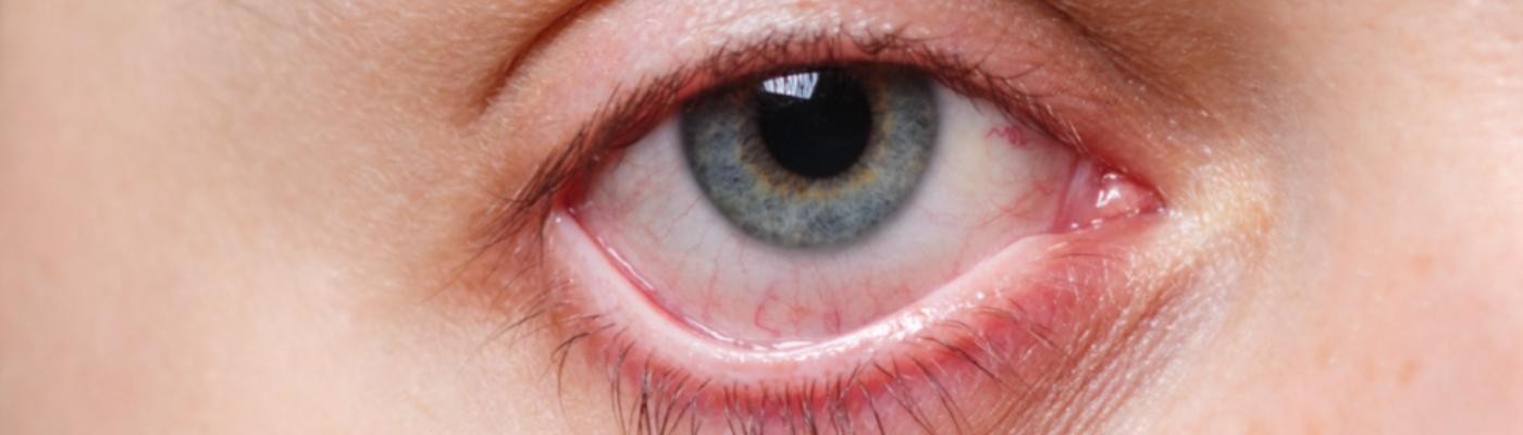 Un examen ocular podría revelar el síndrome de Covid persistente