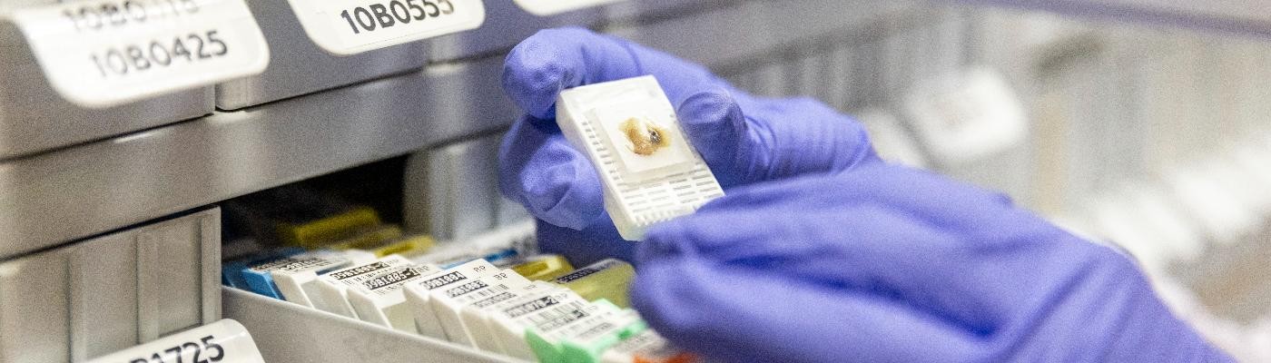Investigadores del CNIO crean la primera colección del mundo de muestras vivas de metástasis cerebral