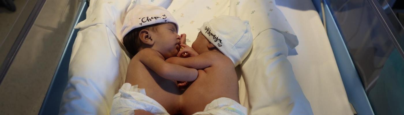 El Hospital Sant Joan de Déu intervendrá a unas gemelas siamesas de Mauritania