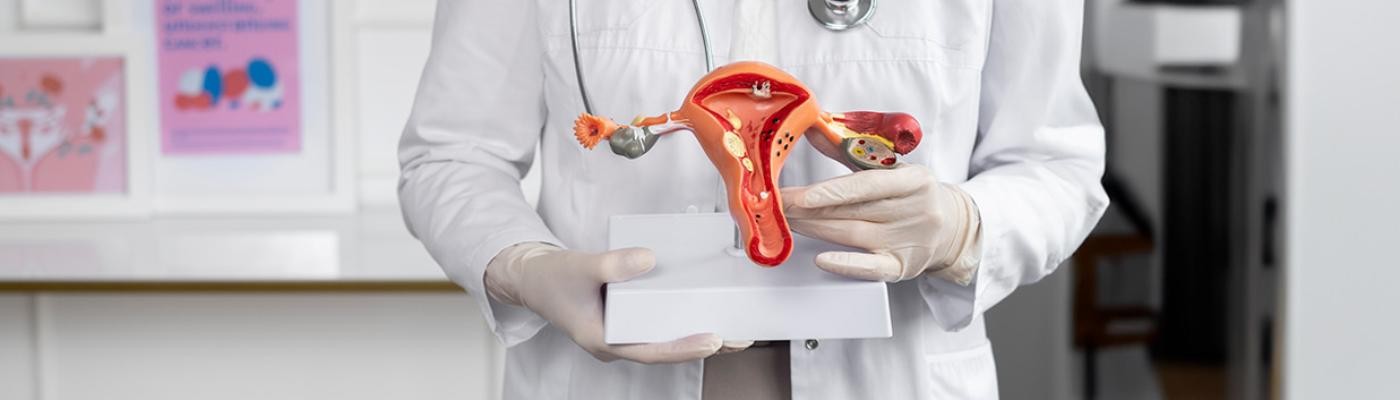 Descubren la forma en la que crecen los tumores uterinos